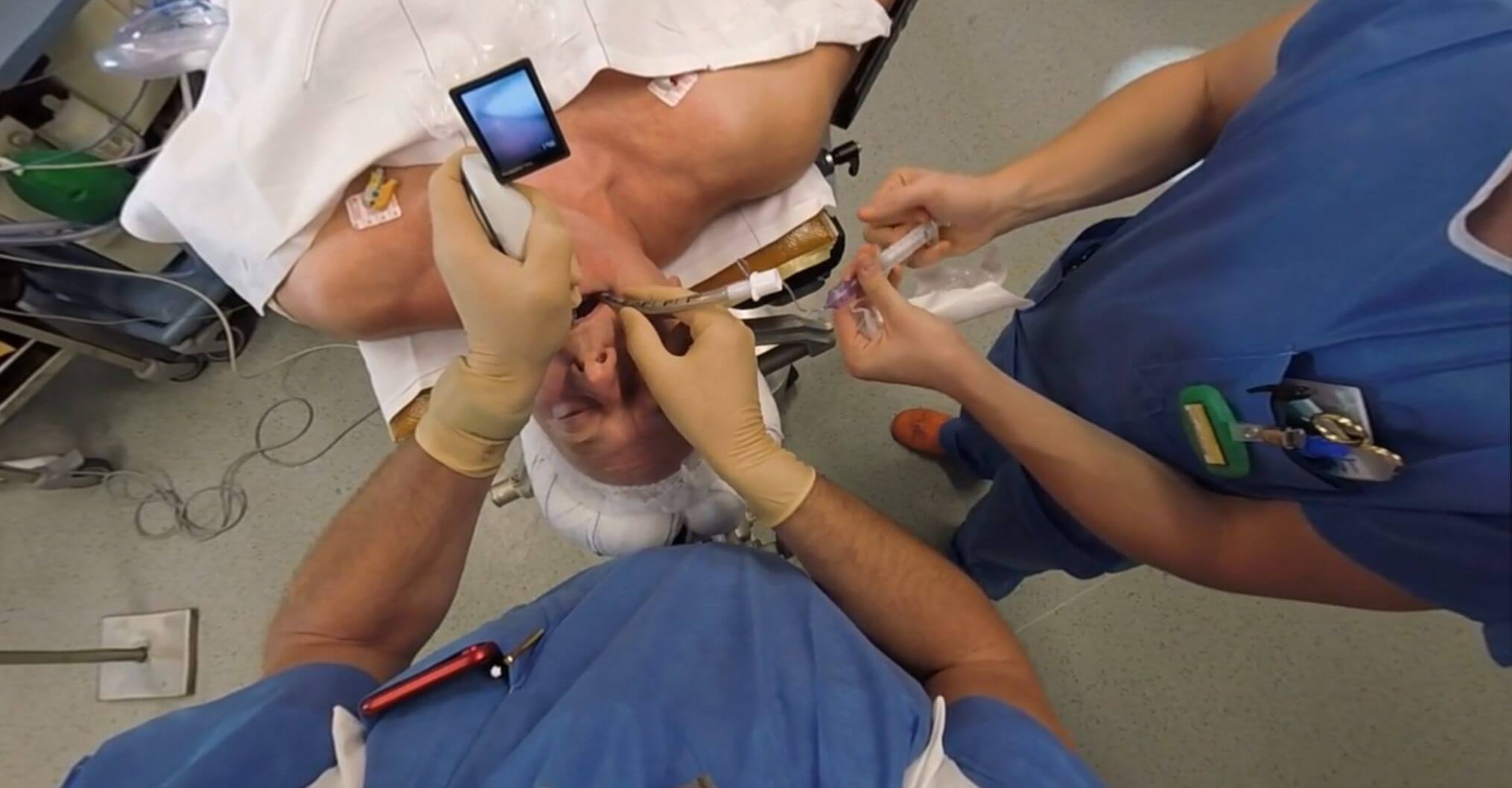 intubation endotrachéale