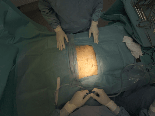 packing pelvien sous péritonéal