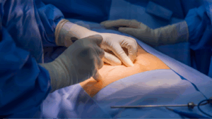 chirurgie lmc digestive